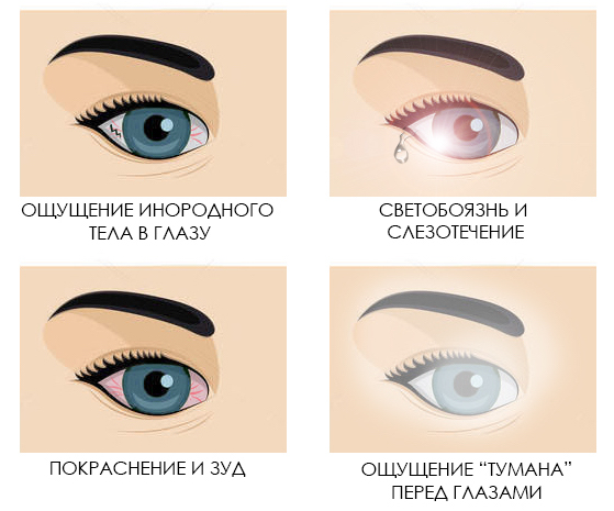 Синдром сухого глаза - причины